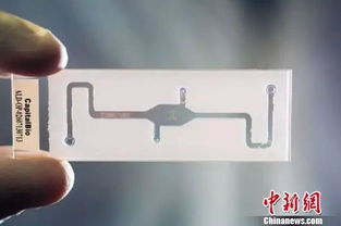 全國320萬新生兒接受遺傳性耳聾基因篩查 軟件開發(fā)的關鍵作用與現(xiàn)代應用